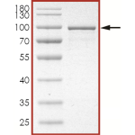 STAT1 beta Protein
